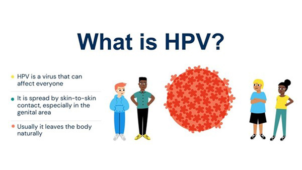 What is HPV infographic: a virus that can affect everyone; spread by skin-to-skin contact; usually leaves the body naturally